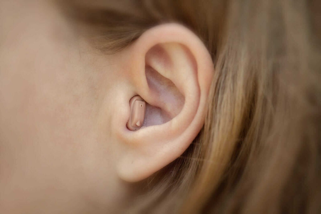 Hearing-Aid-Fitting